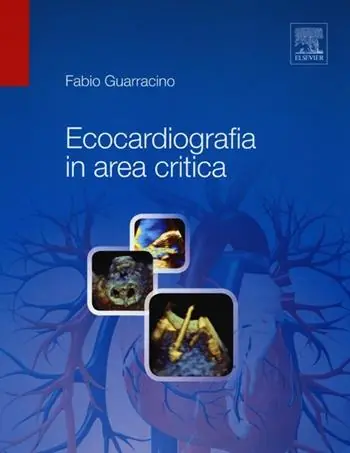 Favoriet Ecocardiografia in area critica