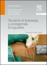 Betrouwbaar Tecniche di anestesia locoregionale ecoguidate