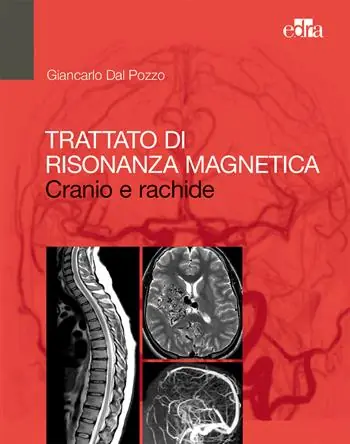 Seizoensaanbieding Trattato di risonanza magnetica. Cranio e rachide