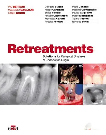 Goedkoop Ritrattamenti. Soluzioni per le patologie periapicali di origine endodontica