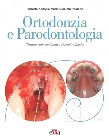 Snelle Levering Ortodonzia e parodontologia. Trattamenti combinati e sinergie cliniche